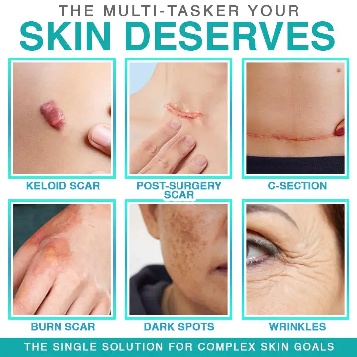 Plaster pielęgnacyjny z mikroigłami BBOJI® 3 w 1 - obrazek 3