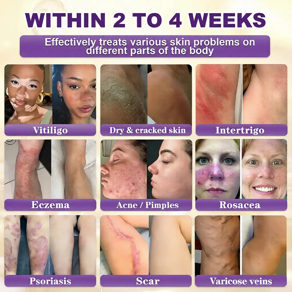 Biotyna Krem regenerujący skórę 10 w 1 - obrazek 2