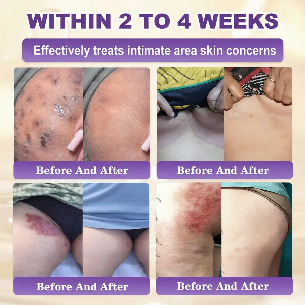 Biotyna Krem regenerujący skórę 10 w 1 - obrazek 4