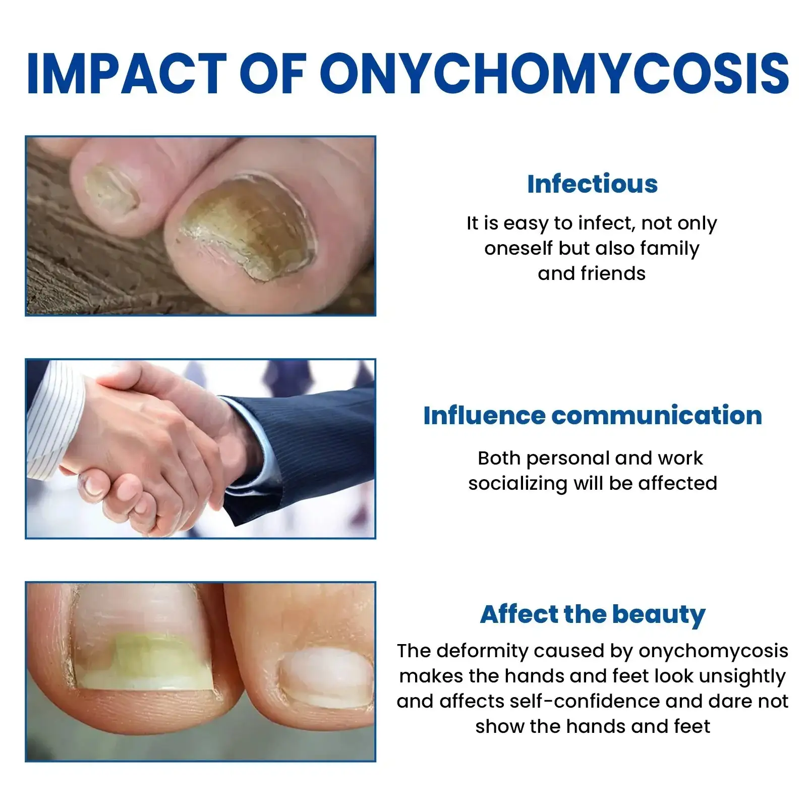 Plastry naprawcze do paznokci na grzyby - obrazek 2