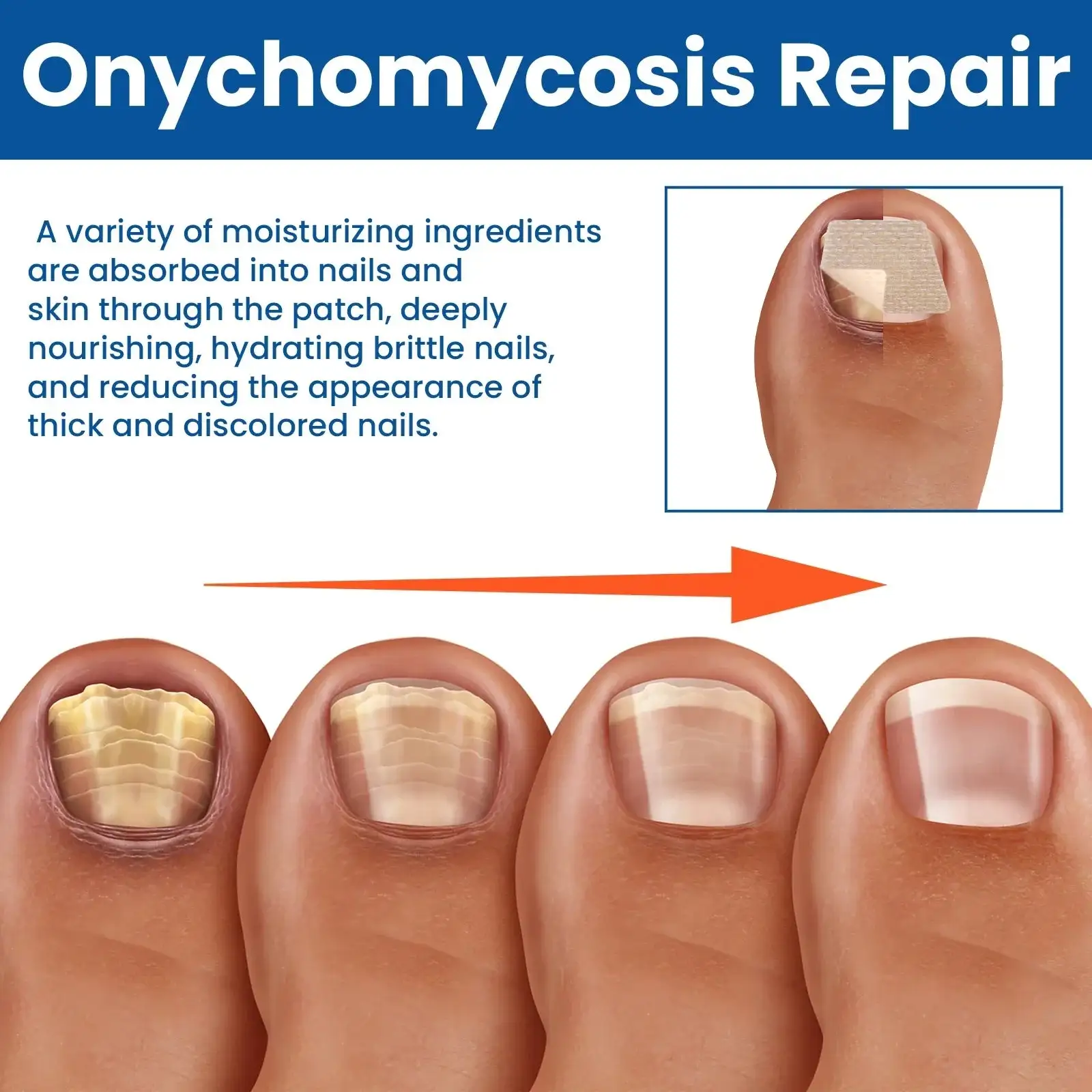Plastry naprawcze do paznokci na grzyby - obrazek 4