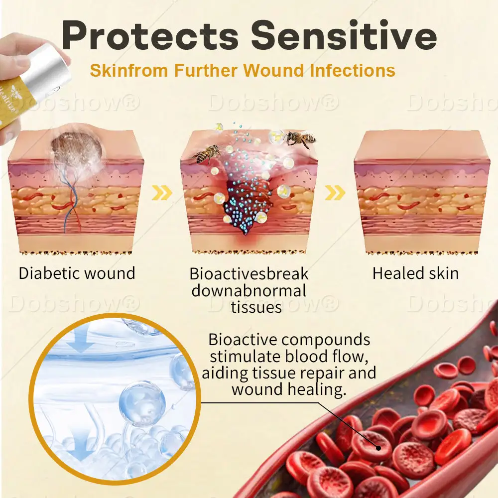 Spray na rany z jadem pszczelim GlucoShield - obrazek 3