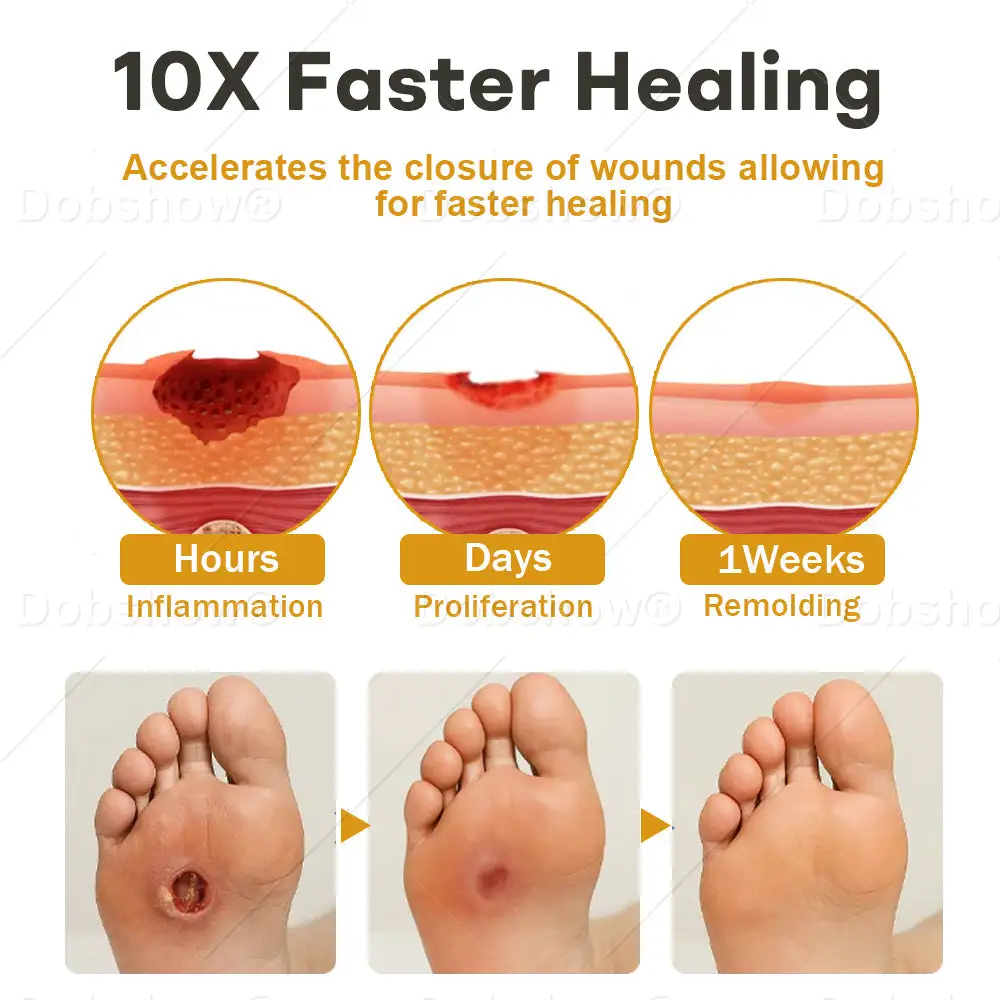 Spray na rany z jadem pszczelim GlucoShield - obrazek 4