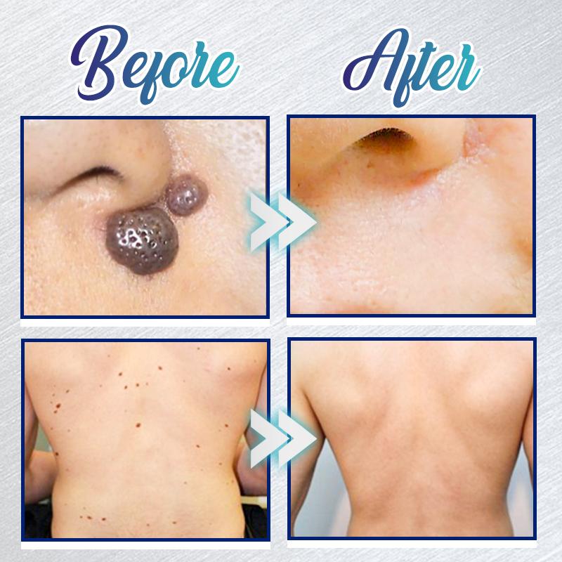 Żel do natychmiastowego usuwania przebarwień - obrazek 3