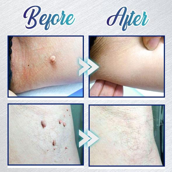 Żel do natychmiastowego usuwania przebarwień - obrazek 4