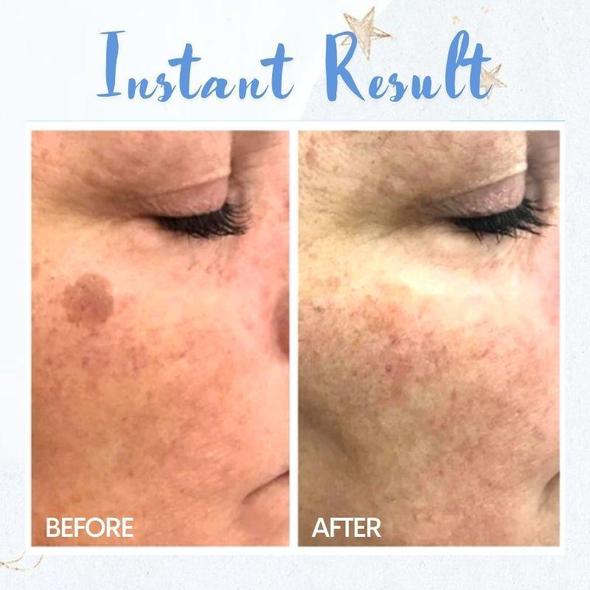 Pióro do usuwania plam - obrazek 3