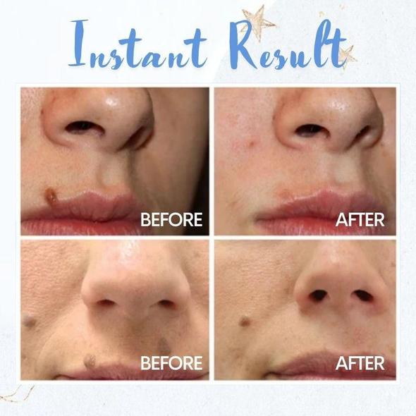 Pióro do usuwania plam - obrazek 2