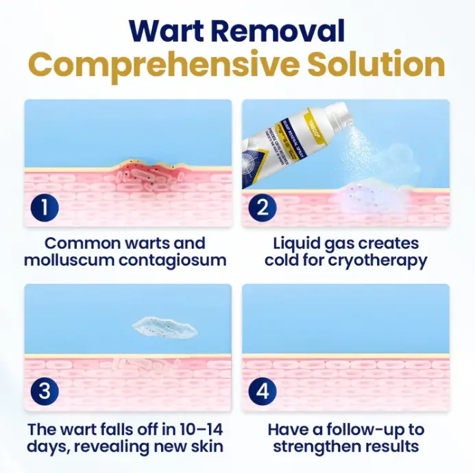 Spray odnawiający guzki Chillique - obrazek 3